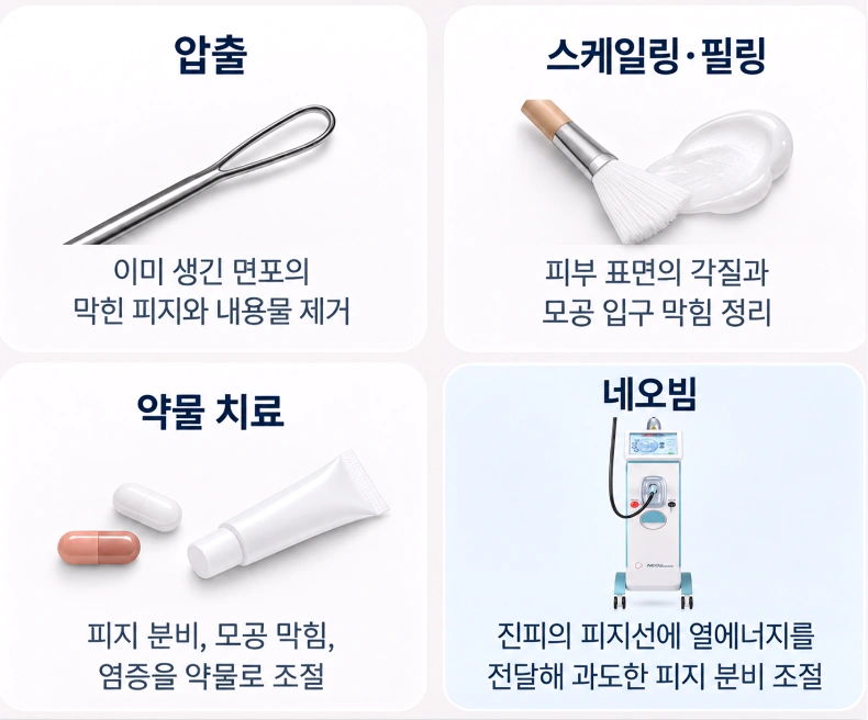 압출·스케일링·약물치료·네오빔을 활용한 여드름 치료 방법