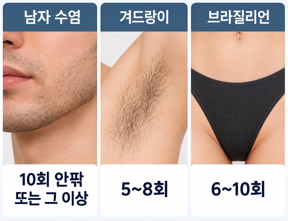 남자 수염, 겨드랑이, 브라질리언 부위의 레이저 제모 권장 횟수를 비교한 이미지